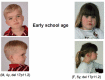 Figure 2. . Early school-age SMS showing male age four years (left) and female age five years (right); the female is also pictured at age 15 years in Figure 3.