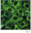 Figure 16-18. Keratin filaments in epithelial cells.