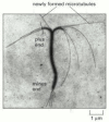 Figure 16-8. The preferential growth of microtubules at the plus end.