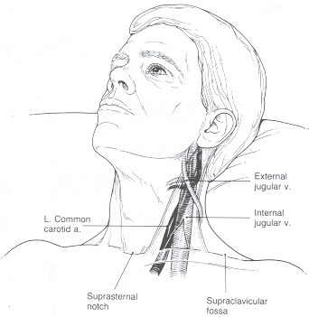 arteries in neck diagram. blood vessels in the neck.