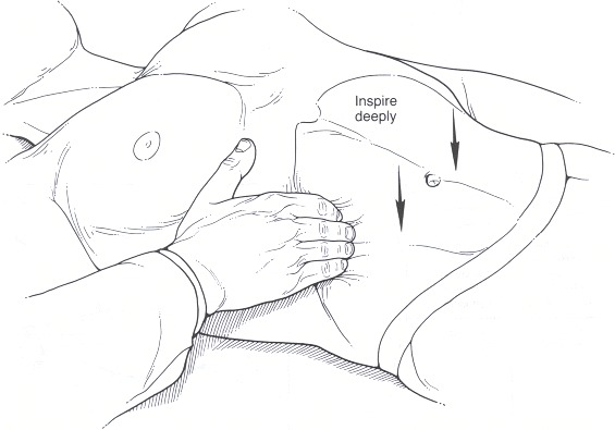 Figure 80.6. Alternative method for palpation of the liver.