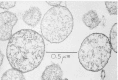 Figure 37-1. Electron micrograph of thin-sectioned mycoplasma cells.