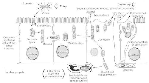 Figure 25-5. Cellular pathogenesis of invasive E coli.