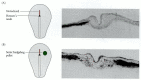 Figure 11.19. Ectopic expression of sonic hedgehog leads to symmetrical nodal expression and randomization of heart looping.