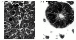 Figure 14.23. LIF induces kidney tubule formation.