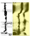 Figure 1. [The normal human retina fundus]. - Webvision - NCBI