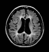 Figure 5. . Brain MRI.