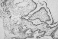 Figure 91-6. Photomicrograph of a plexiform ameloblastoma (hematoxylin and eosin ×100).