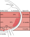 Figure 85-4. Artistic rendition of relationship between age at diagnosis, surface area of involved retina, and location of intraocular foci of retinoblastoma.