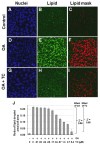 Figure 4. Effects of oleic acid (OA) and triacsin C (TC) on lipid droplet formation in AML12 cells.