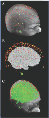 FIGURE 15.3. (A) Digitized sources (red dots) and detectors (yellow dots) overlaid on a subject’s structural MRI; (B) Sources and detector projected onto the brain with scalp and skull removed; (C) Overlapping “spindle” volumes used for 3D reconstruction, emanating from source-detector pairs.