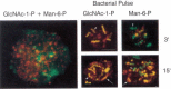 Figure 12.3. (Left panel) Dictyostelium amoeba were stained with an antibody against GlcNAc-1-P (FITC, green) or Man-6-P (TRITC, red).