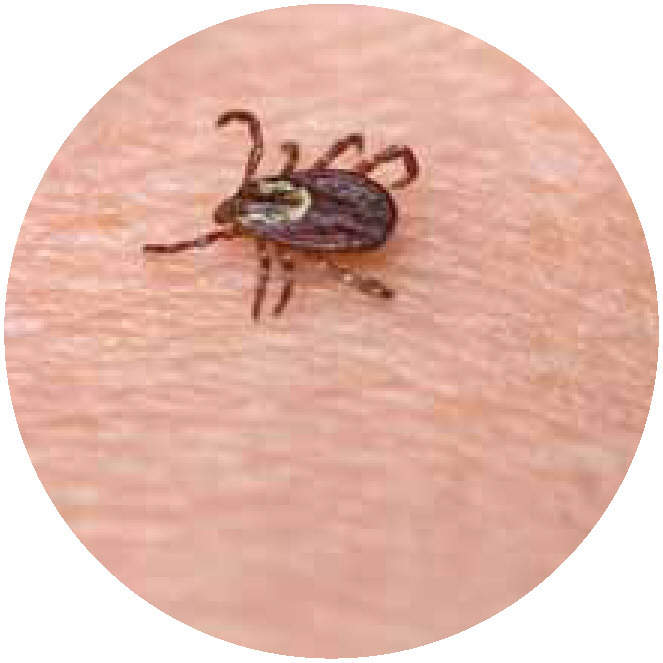 美国狗蜱，落基山斑疹热的潜在媒介。