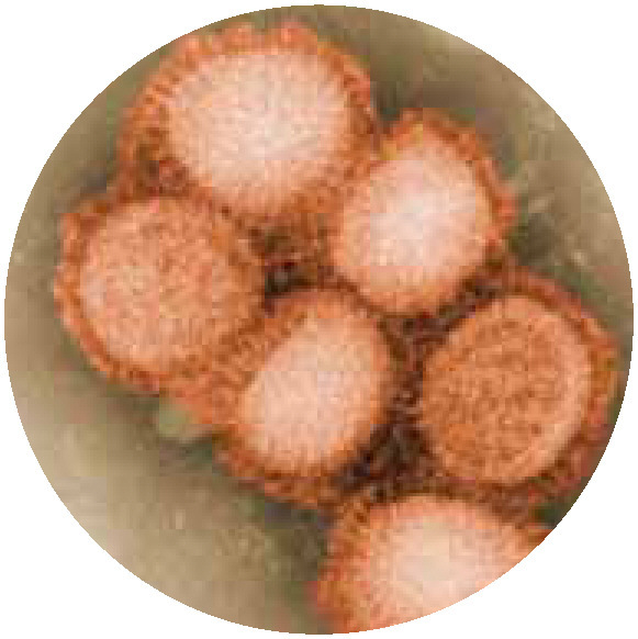 2009年H1N1流感病毒。