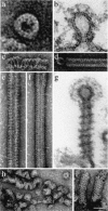 Figure 2. Dynamin rings and spirals and dynamin-lipid tubes resemble the collar structures seen in shibire and the striated tubules observed in synaptosomes treated with GTPγS.