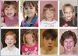 Figure 1. . Photographs of eight individuals with a 17q21.