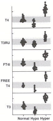 Figure 142.1. Thyroid function studies in normal subjects and in hypothyroid and hyperthyroid patients.