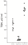 Figure 142.2. Serum TSH in various states of thyroid function.