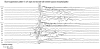 Figure 5.4. The burst–suppression pattern in a neonate with severe hypoxic encephalopathy.