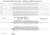 Figure 10.7. Video EEG of an 8-year-old boy with classical CAE.