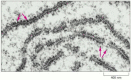 Figure 6-62. Ribosomes in the cytoplasm of a eucaryotic cell.