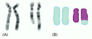 Figure 4-12. An aberrant human chromosome.