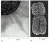 Figure 4-21. A comparison of extended interphase chromatin with the chromatin in a mitotic chromosome.