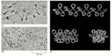 Figure 4-29. Variations on the Zigzag model for the 30-nm chromatin fiber.