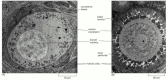 Figure 20-24. Electron micrographs of developing primary oocytes in the rabbit ovary.