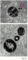 Figure 13-32. Histochemical visualization of lysosomes.