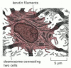 Figure 22-3. A prickle cell.