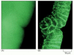 Figure 9-19. Conventional and confocal fluorescence microscopy compared.