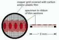 Figure 9-24. The copper grid that supports the thin sections of a specimen in a TEM.