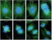 Figure 18-8. The course of mitosis in a typical animal cell.