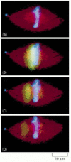 Figure 18-20. The dynamic behavior of microtubules in the metaphase spindle studied by photoactivation of fluorescence.