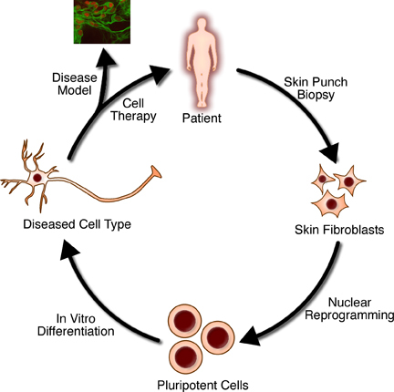 Figure 1, The steps of regenerative medicine. - StemBook - NCBI