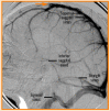 Figura 17. Drenaje venoso del cerebro y del cráneo.