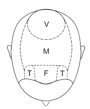 Figure 2. . Areas of the scalp.