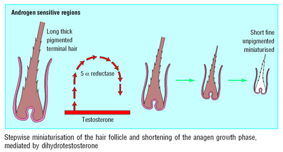 Figure 4. . Progressive miniaturization of hair in each cycle.