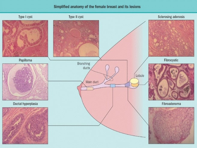 Female breast (Illustration, Anatomy) - DocCheck