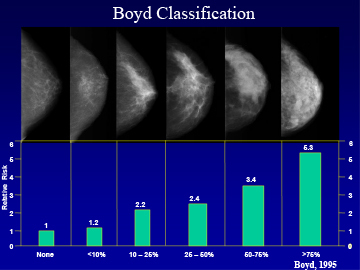 Figure 10. The percentage of breast tissue which is dense on a mammogram is determined by computer assisted analysis and classified as none, <10%, 10-25%, 25-50%, 50-75%, >75%.The relative risk of breast cancer increases with each step of increased breast density. Adapted from that data of Boyd et al (25).