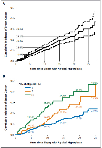 Figure 8. Incidence of breast cancer in cohort of patients with a histologic diagnosis of atypical hyperplasia. Top panel: mean (solid line) and 95% confidence limits (dashed lines). Bottom panel: Incidence in patients with 1, 2, or 3 or more independent lesions. Reprinted with the permission of the authors and publisher from Hartmann LC et al (23).