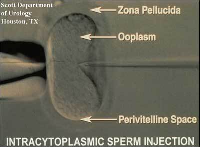 Frontiers  The pregnancy outcomes of infertile women with polycystic ovary  syndrome undergoing intrauterine insemination with different attempts of  previous ovulation induction