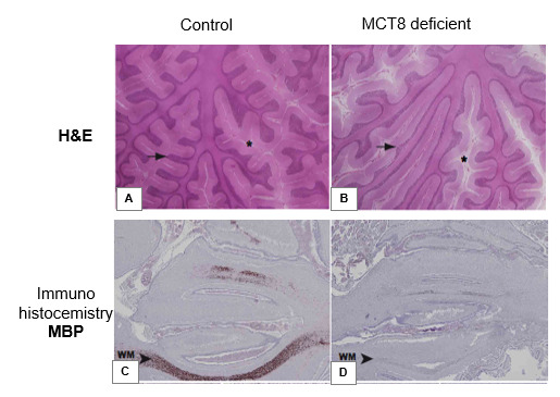 Figure 11. . Structure and myelination of the fetal and juvenile cerebellum.