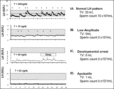 Fig. 2. Spectrum of GnRH-induced LH secretion in men with GnRH deficiency.