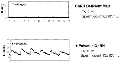 Fig. 6. LH and testosterone (T) at baseline and in response to GnRH therapy in a man with complete GnRH deficiency.