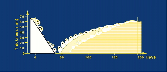 Ultrastructure of Bone - Components - Structure - TeachMeAnatomy