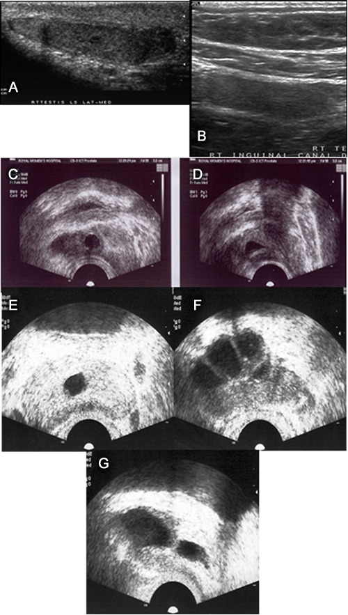 Clinical Management of Male Infertility - Endotext - NCBI Bookshelf