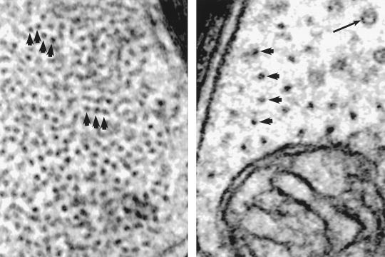 Figure 8-4. Glial filaments and neurofilaments are easily recognized in electron micrographs.