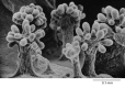 Figure 1-31. Fruiting bodies formed by a myxobacterium (Chondromyces crocatus), seen by scanning electron microscopy.